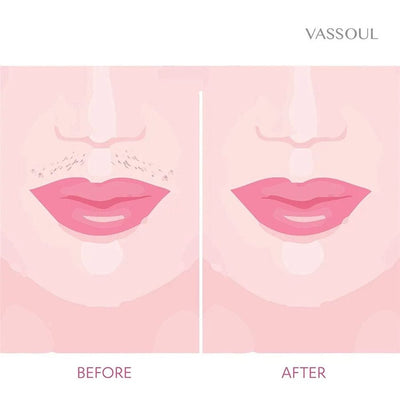 CELL OPERATED FLAWLESS WOMEN PAINLESS HAIR REMOVER FACE FACIAL HAIR REMOVER
